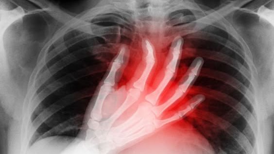 "نانوم ننرمند" tweet media