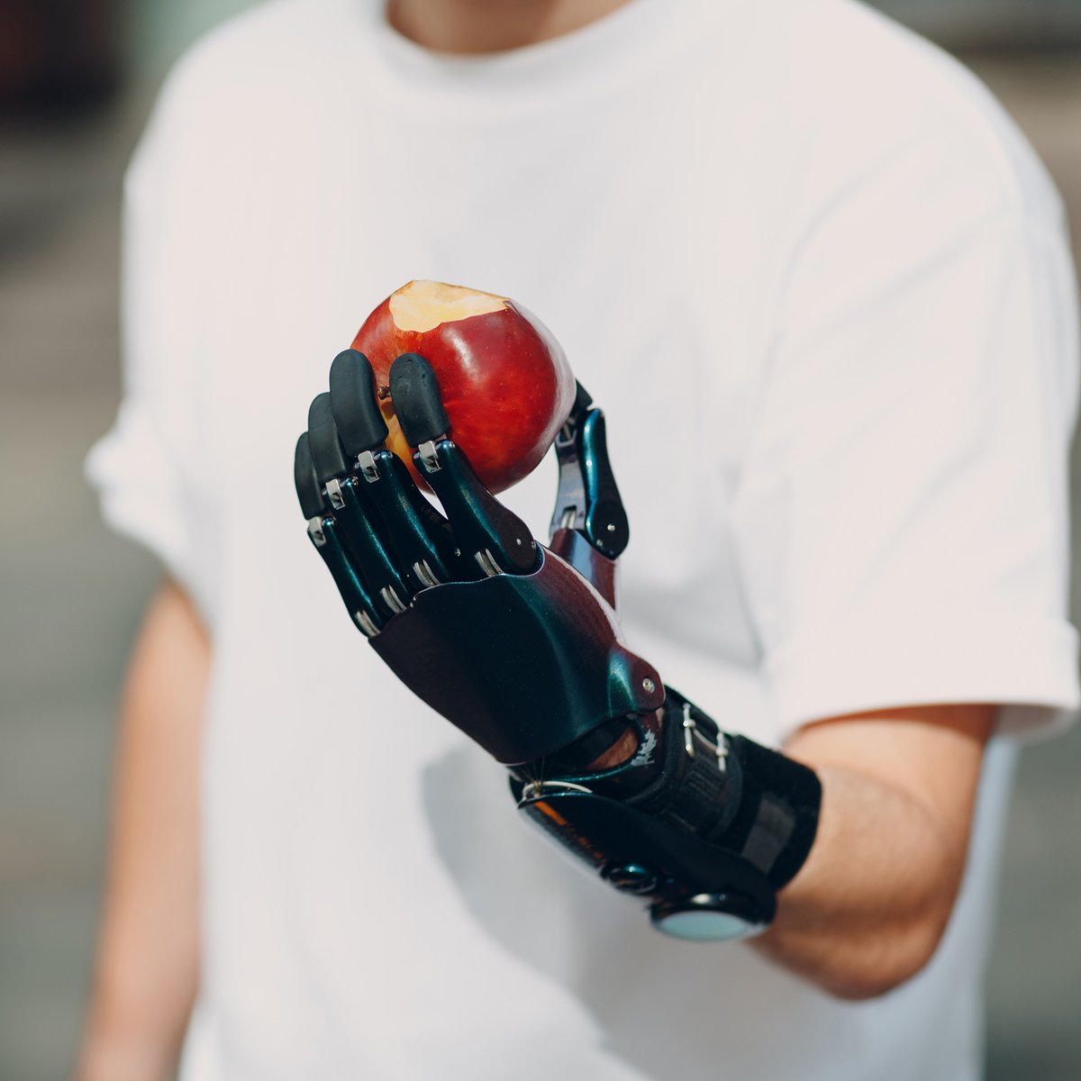 Most prosthetic arms cannot feel pressure. You rely on sight and sound instead of touch, never fully sure if you are holding too hard or too softly. Simple tasks demand full attention and can be tiring. Luckily there is solutions out there and the tech gets better every day!