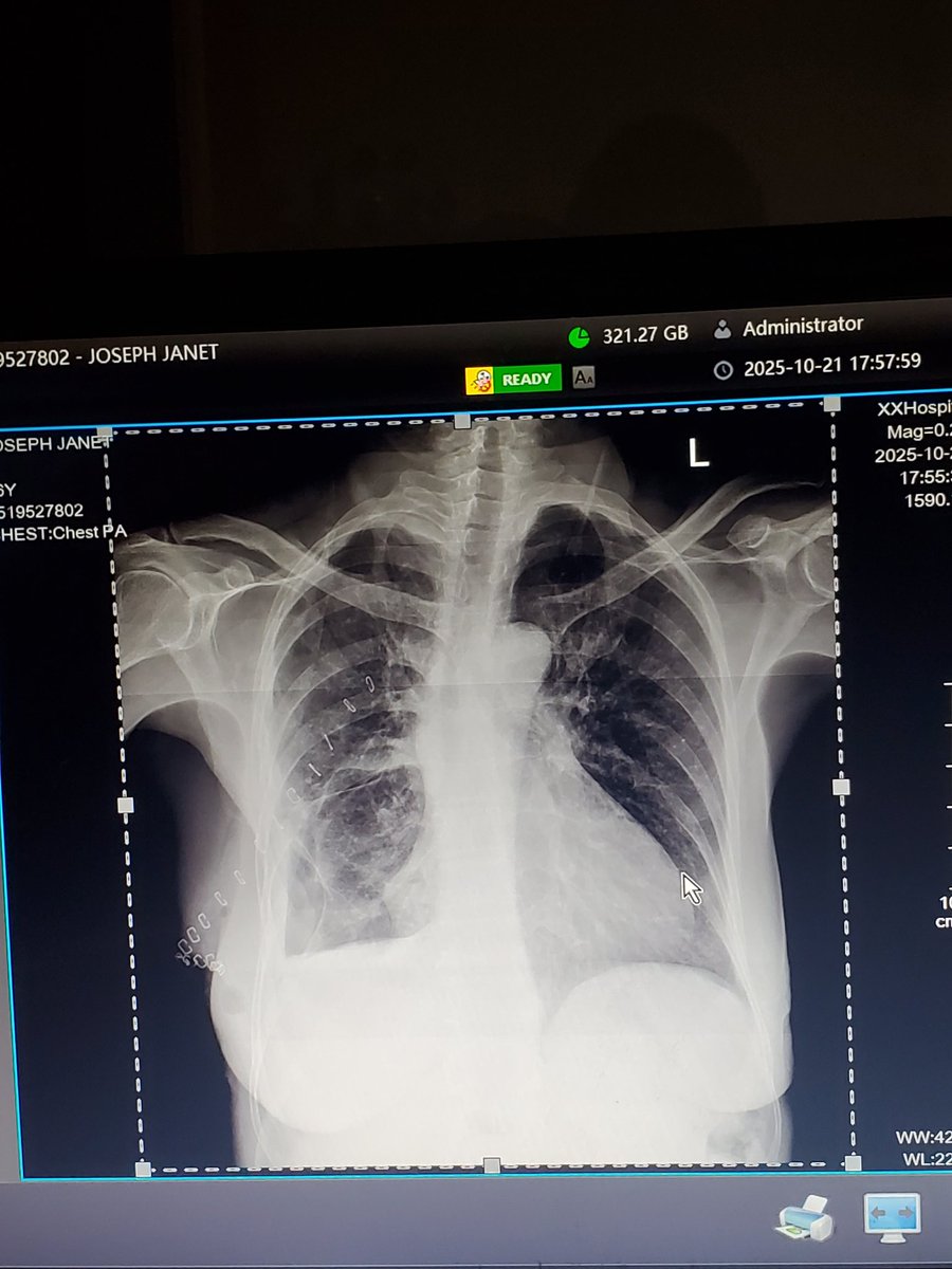 Cancer of the lungs is gradually taking my mother, and we are pleading for help.

I never imagined I’d have to write this, but we are overwhelmed and running out of options.