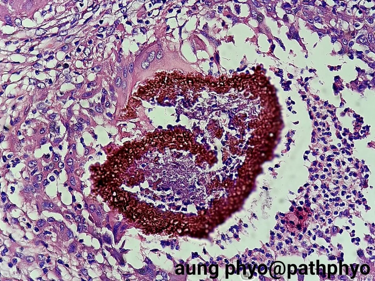 aung phyo tweet media