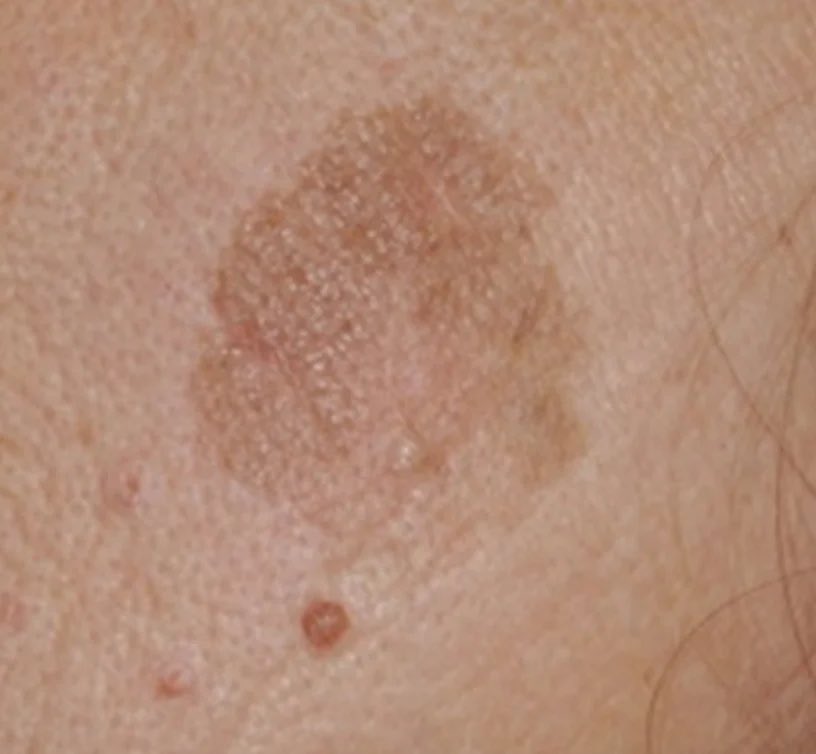 Pathology Interest Group | باثِج tweet media