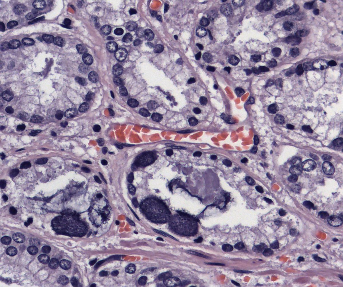 Perspectivapatológica tweet media