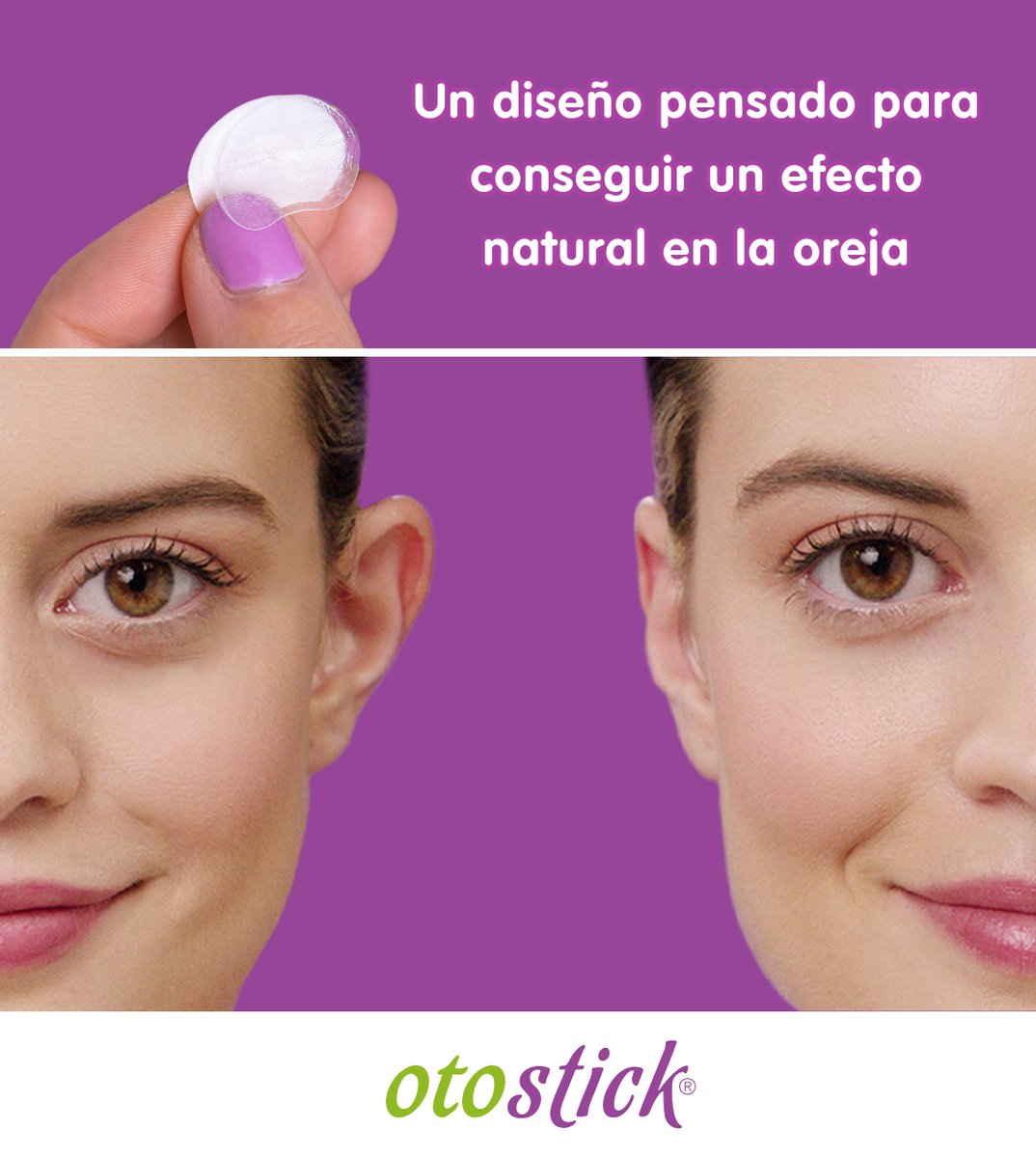 Otostick ha sido diseñado para ofrecer un efecto completamente natural en tu orejita, logrando una apariencia estética y discreta desde el primer momento. 😉👂🏼

otostick.com
💜💚💜💚