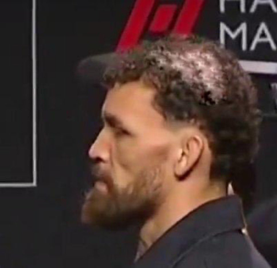 Obsessionmmapod's tweet image. Mauricio Ruffy a developpé une calvitie Norwood 5 après avoir affronté Benoît Saint Denis.