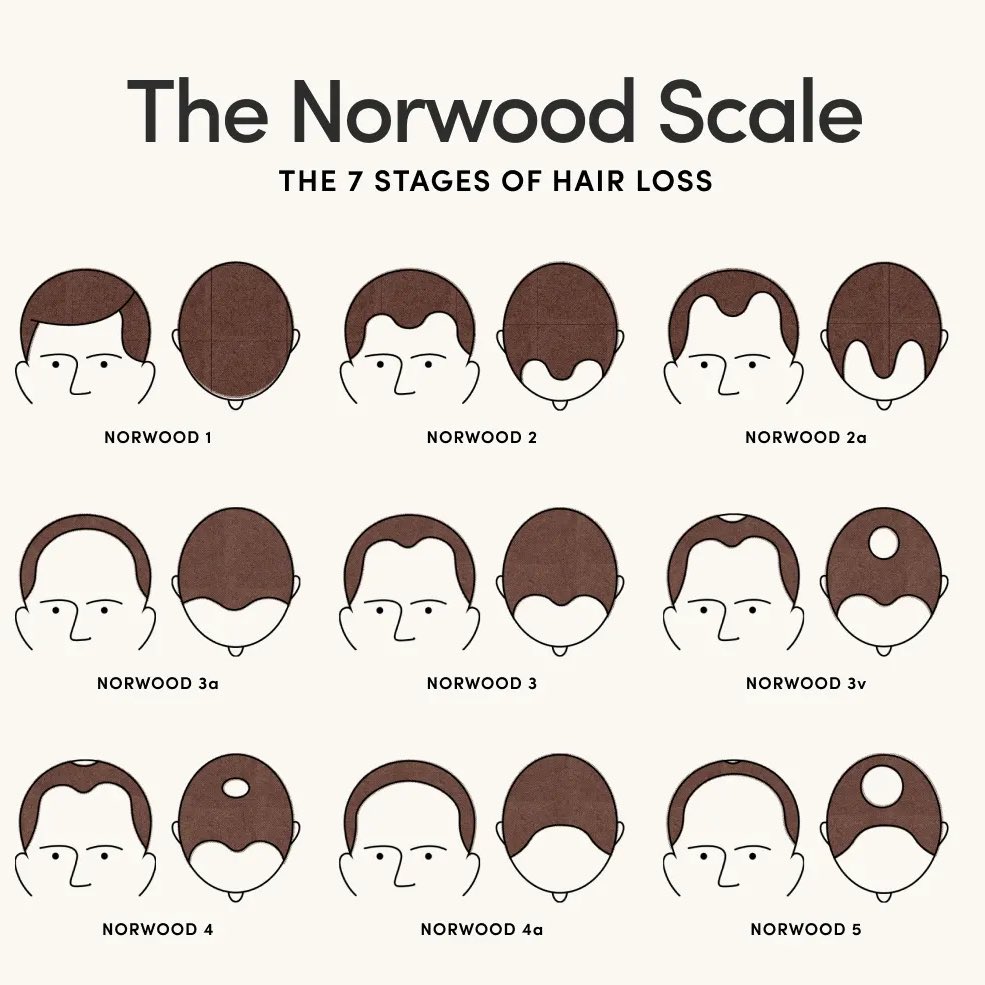 Obsessionmmapod's tweet image. Mauricio Ruffy a developpé une calvitie Norwood 5 après avoir affronté Benoît Saint Denis.