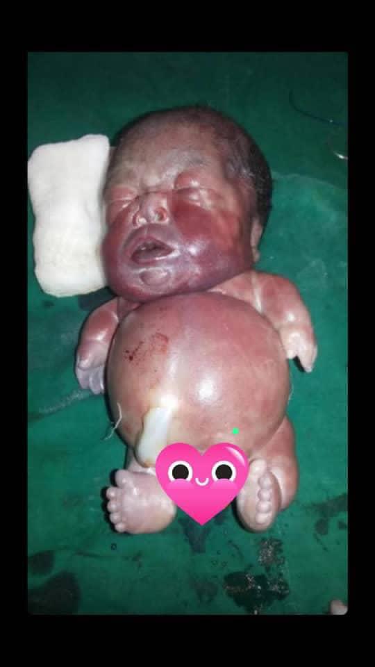 Abdul_Ahmad_'s tweet photo. Have You seen PHOCOMELIA  – A Rare Birth Condition?

#safebaby #safemother https://t.co/dTF7Ra1qcV