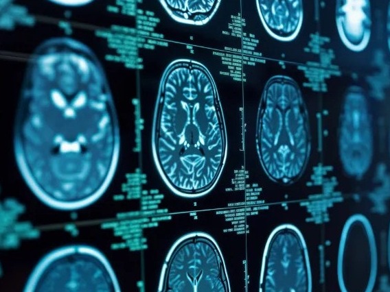 KCLalumni's tweet photo. 🧠 A new study by academics at King’s explores how an artificial intelligence innovation could help radiologists identify brain abnormalities such as strokes and aneurysms.

🔗 Read more https://t.co/FPALxqBgEE 
#ForeverKings🦁 @kingsmedicine @KingsImaging @aiatkings https://t.co/mz00Ooa3Jn