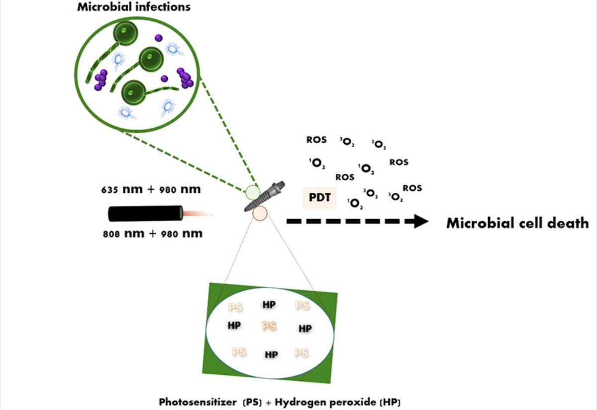 Bioeng_MDPI's tweet photo. 💥Highly recommended paper: "Simultaneous Dual-Wavelength #Laser #Irradiation against Implant-Adherent #Biofilms of #Staphylococcusaureus, #Escherichiacoli, and #Candidaalbicans for Improved #Antimicrobial #PhotodynamicTherapy"
🔗 https://t.co/BlQAQ3UMeM
🏫 @TehUofMed @UniGenova https://t.co/HeHKv0H6uh