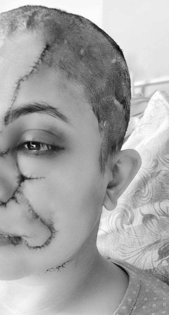 Bavazir_network's tweet image. Pet #DogAttacks Woman During Morning Walk in #Bengaluru

A woman was seriously injured after being attacked by a pet dog while she was on a morning walk in the #TeachersColony of #HSRLayout in Bengaluru.

The incident occurred when the dog, reportedly from a nearby house in the