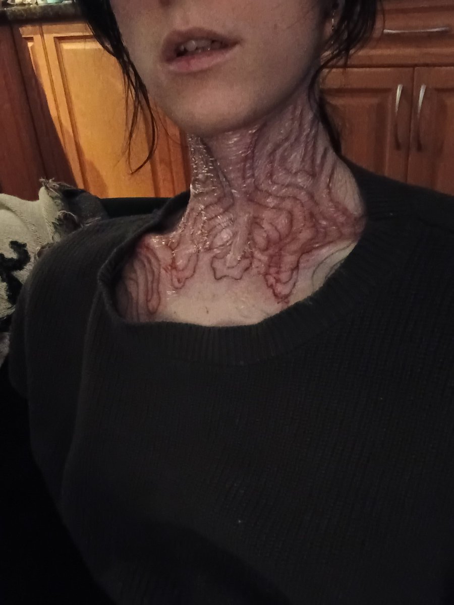 _zombibi's tweet photo. gonna be blacking out my neck :>> https://t.co/wBeisS5KTm