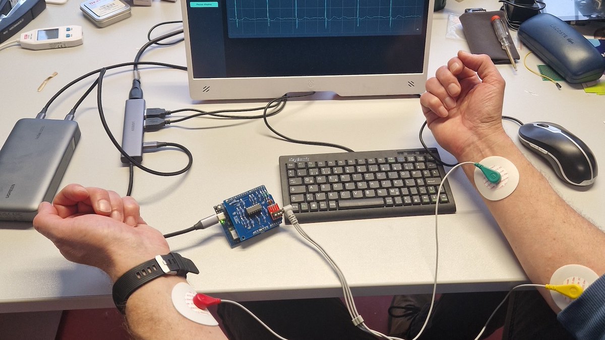Jens Bongartz designed a simple ECG amplifier Arduino shield that enables standalone data acquisition, processing, and real-time visualization using the UNO Q: projecthub.arduino.cc/jens-bongartz/…