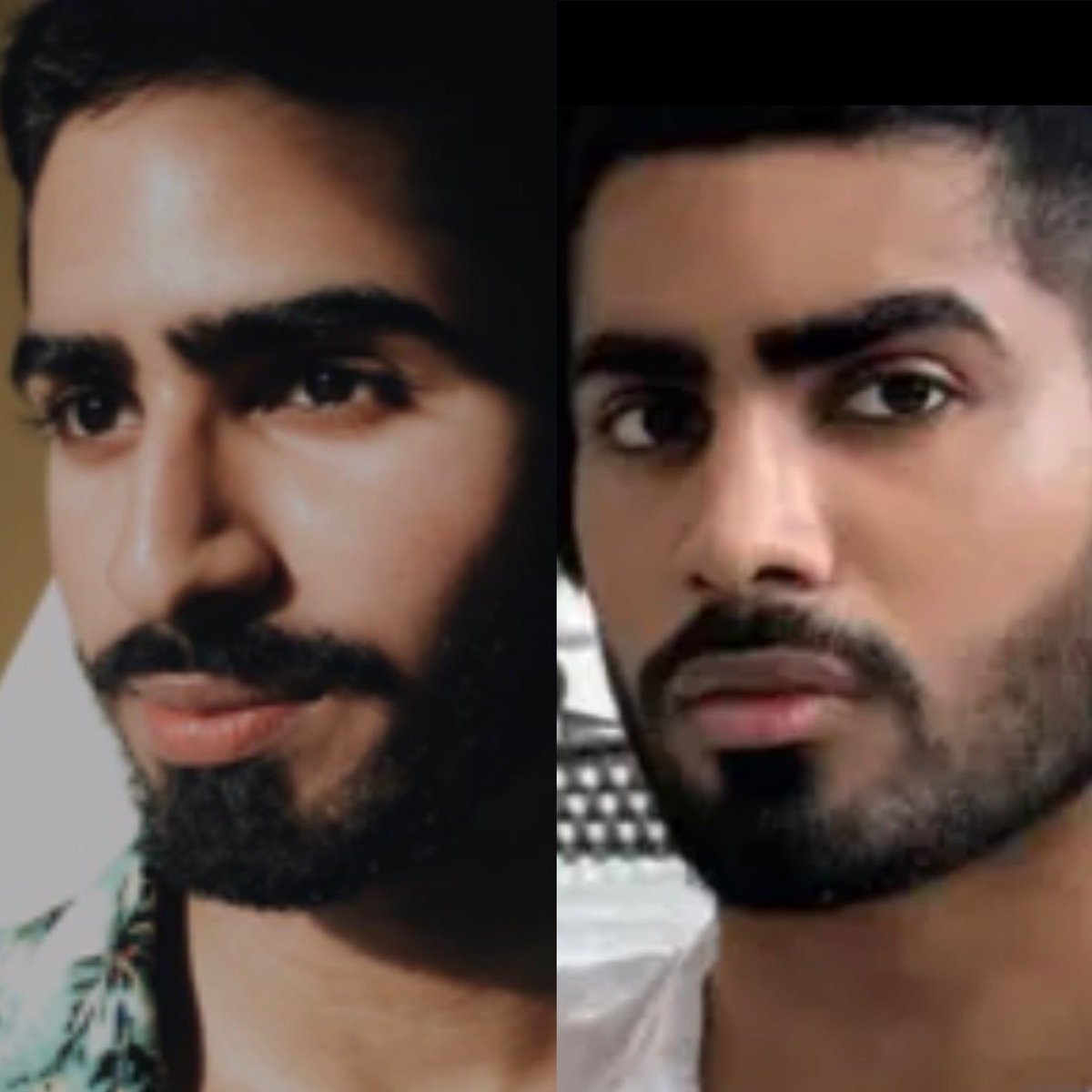 Male rhinoplasty Asia to NYC! #malerhinoplasty Beauty Broker superfan!