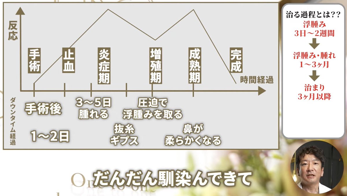 hanawokireini's tweet photo. 鼻のDT解説これが一番分かりやすかった！

・48時間：止血のため冷やすのが有効
・2週間：炎症が治る
・1ヶ月：増殖期で腫れ始める
→ 腫れて丸くなるから心配になる
→ 圧迫が有効なので、テーピングが有効。酷ければギプスしても。
・3ヶ月：増殖が止まる

https://t.co/AIGLgOzc1B https://t.co/ji8824XkXh