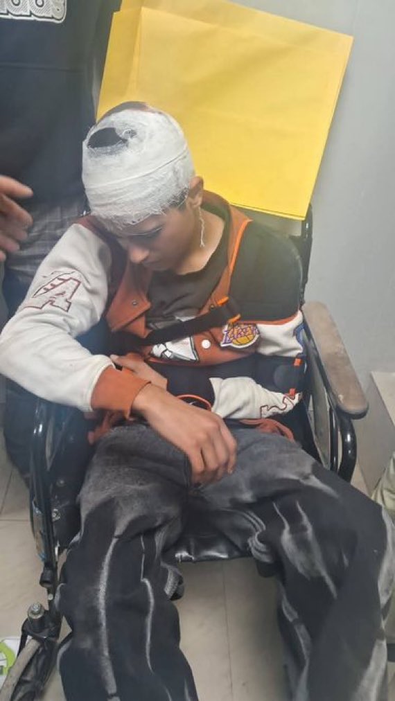 A 18-yr old Kashmiri Muslim boy, who sells shawls, has been brutally beaten and seriously wounded by a Hindutva mob in Uttakhand, India. This is the way, they are winning hearts and minds of Kashmiris!