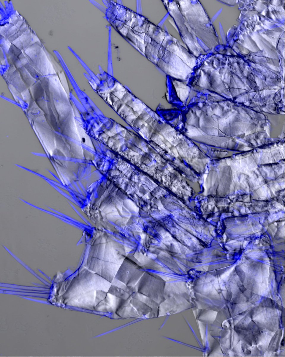 zeiss_micro's tweet image. Winter is not a season. It’s a pattern. ❄️🔬
Across materials science and biology, the same geometries repeat.
Branching. Layering. Crystallizing.
Which #microscopy image feels most “winter” to you, and why?
#WinterAesthetics #ZEISSMicroscopy