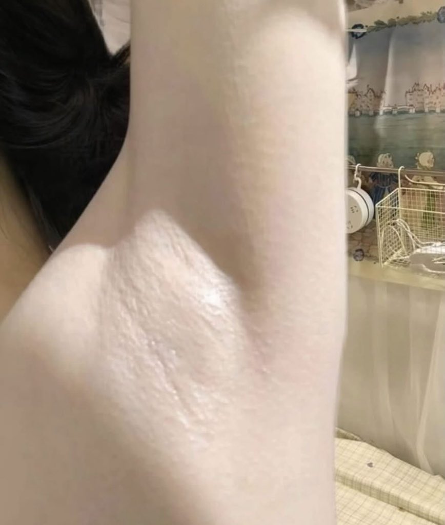 TOLONG BELI INI GUYS!!!
Ini rekomendasi dokter SpKK dipakai 2–3x seminggu aja, not every night ya dalam 2 weeks hasilnya udah keliatan. Ketiak looks cleaner, brighter, and smoother. No instant, but it works.