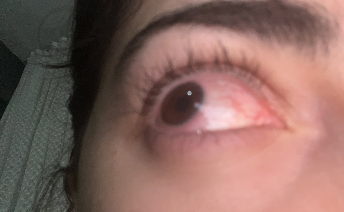 tw kullanicisi tweet media