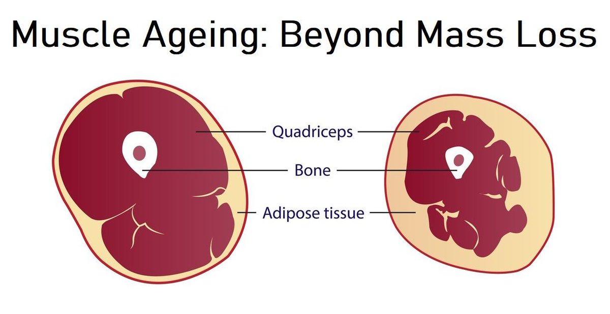 TMGBMC's tweet photo. Muscle quality declines before muscle mass.
An 8-year longitudinal cohort study highlights why contractile properties matter in ageing research.
More here 👇
https://t.co/oOQgyRyCKw
#Gerontology #MusclePhysiology #Tensiomyography https://t.co/JpR87t5Gec