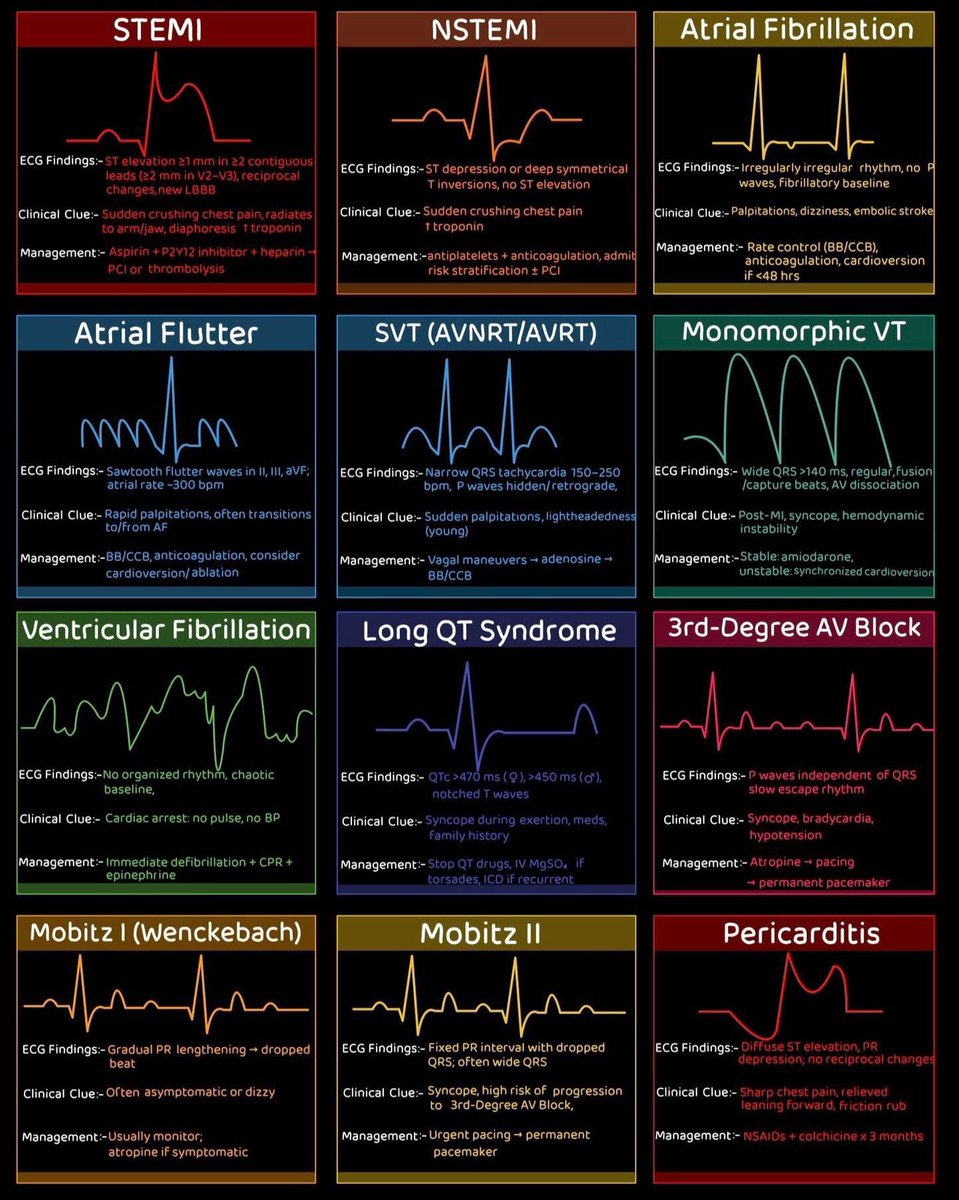 💢PATRONES  ELECTROCARDIOGRÁFICOS

#ENARM_INTENSIVO #ESTUDIA_MEDICINA