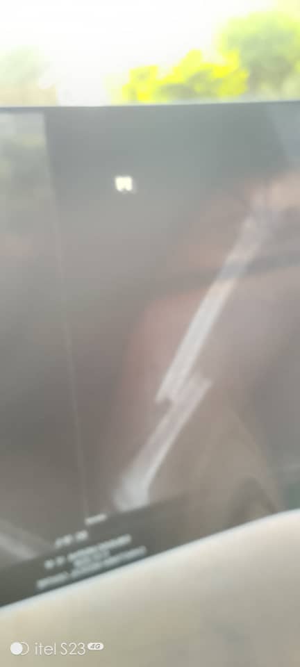 obertdube_poet's tweet image. A 10 yr old child broke his thigh when a tree fell on him .he has been admitted at Vic Falls hospital for 20 days.
He is supposed to be taken to Bulawayo but  the mother has been told she should fuel the ambulance, $300 needed.
Metrina
0777375706(ecocash)
Pliz help
Retweet this