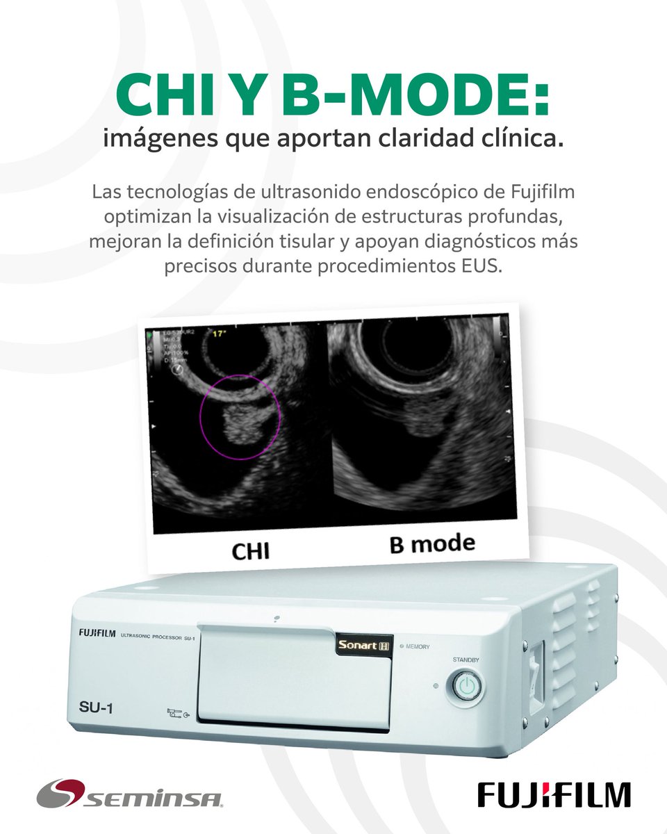 seminsaoficial's tweet photo. CHI y B-Mode de Fujifilm: mayor definición y claridad clínica para procedimientos de ultrasonido endoscópico, optimizando la visualización de estructuras profundas y apoyando diagnósticos más precisos.
#SEMINSA #Fujifilm #Endoscopia https://t.co/bvcaAvCSVf