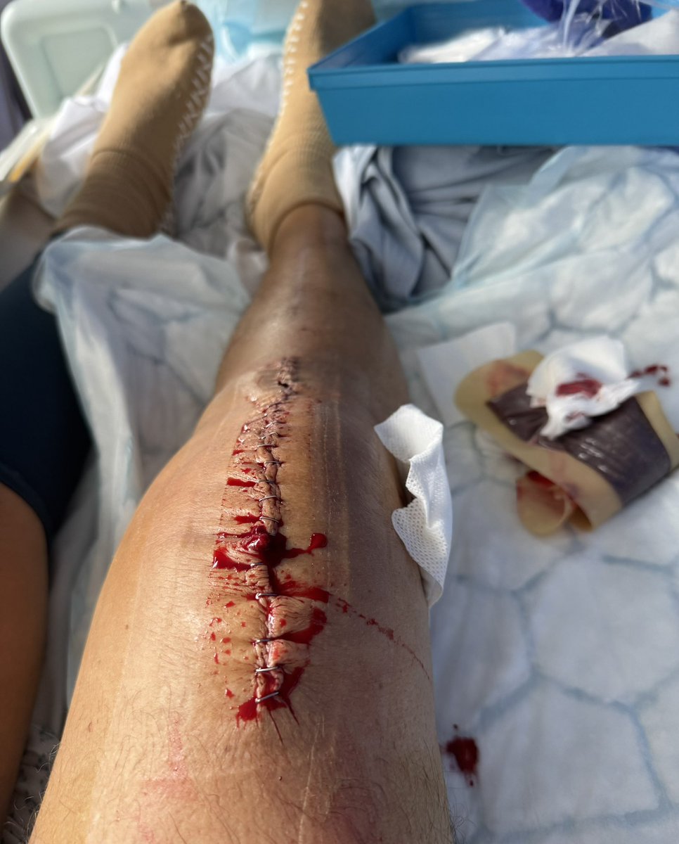 Wendy Oldershaw tweet media