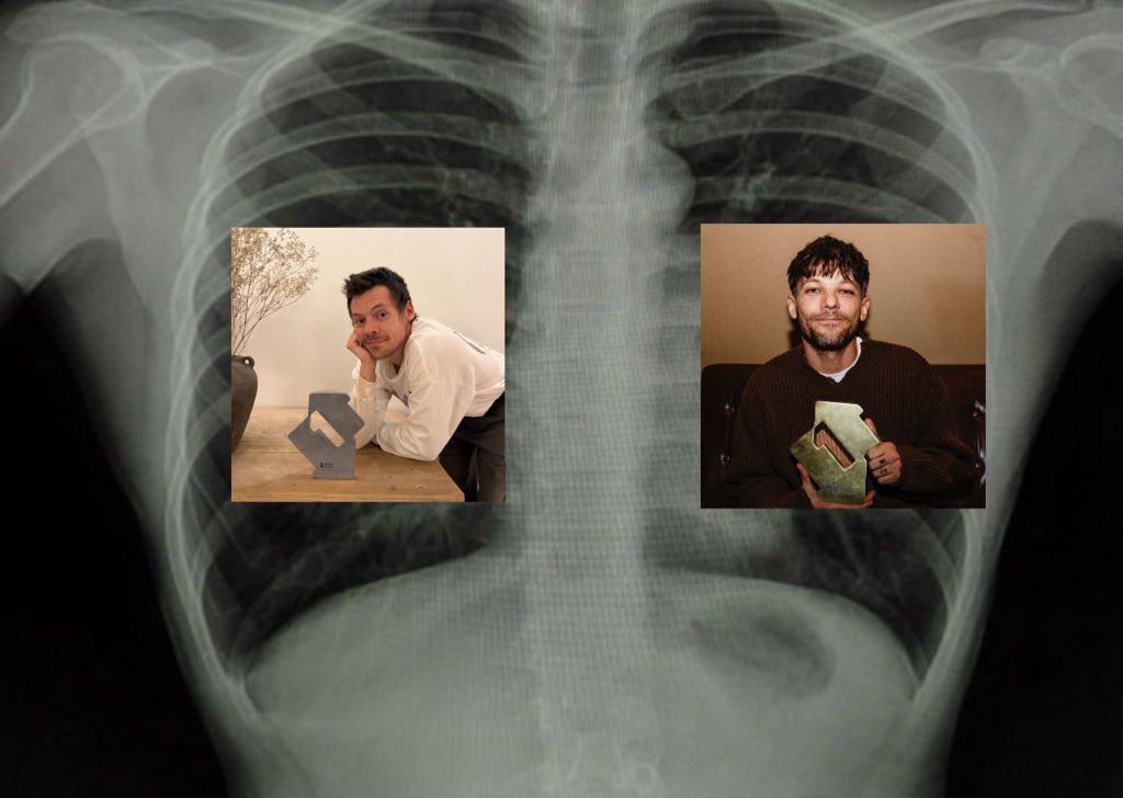 aleestyles91's tweet image. well yes