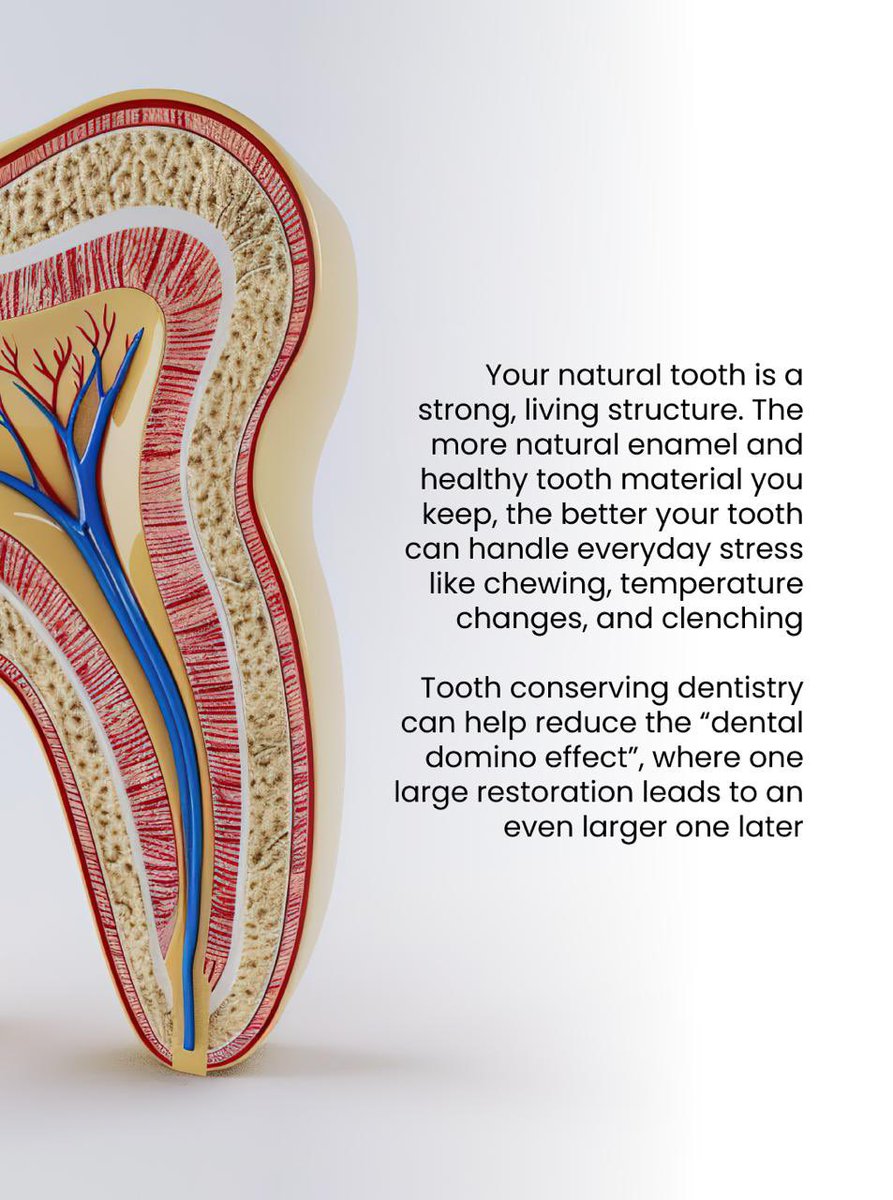 BeataCarlson's tweet image. Smaller, thoughtful interventions can support stability and comfort for years to come. 

💡 Want to learn more about conservative dental care? Follow us for more insights.

 #ToothConservation #HolisticDentistry #HealthySmile