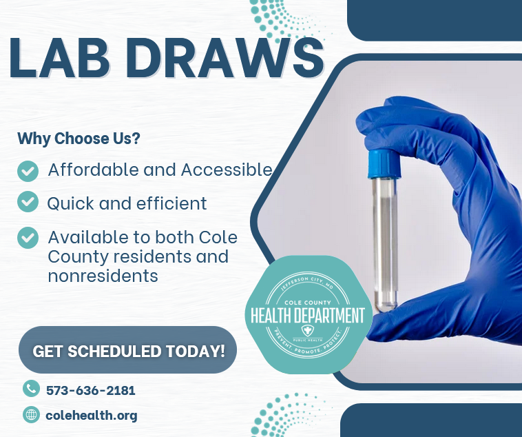 Need labs done? We’ve got you covered!
CCHD provides lab draws with a physician’s order. These services are self-pay at a discounted rate, making the process quick, affordable, and accessible! 
Call to schedule an appointment today – or feel free to walk-in, we are happy to help!