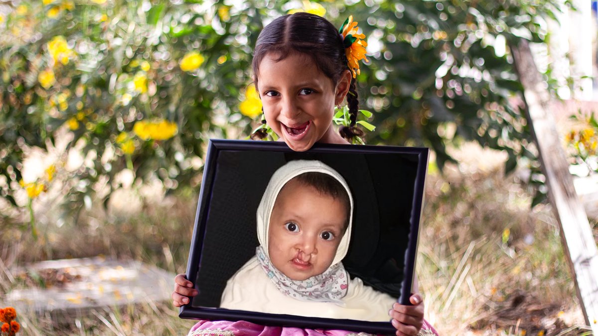 Smiletrain's tweet photo. Meet Lia from Mexico! 🇲🇽 Born with a cleft, she received life-changing surgery through Smile Train’s local partner. Today, she’s learning, playing, and thriving.
Every child deserves a chance to smile.
#smiletrain #cleft #cleftcare https://t.co/hSqHtvzwcC