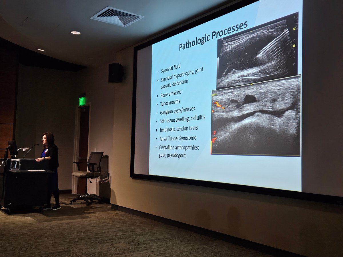 USSONAR_Rh's tweet photo. Dr @minnakohlermd teaches ultrasound of the Ankle, anatomy, pathology!
#RA #psoriaticarthritis #enthesitis #gout #CPPD #ussonar26 #rhmsus https://t.co/lrNlJY8z0K
