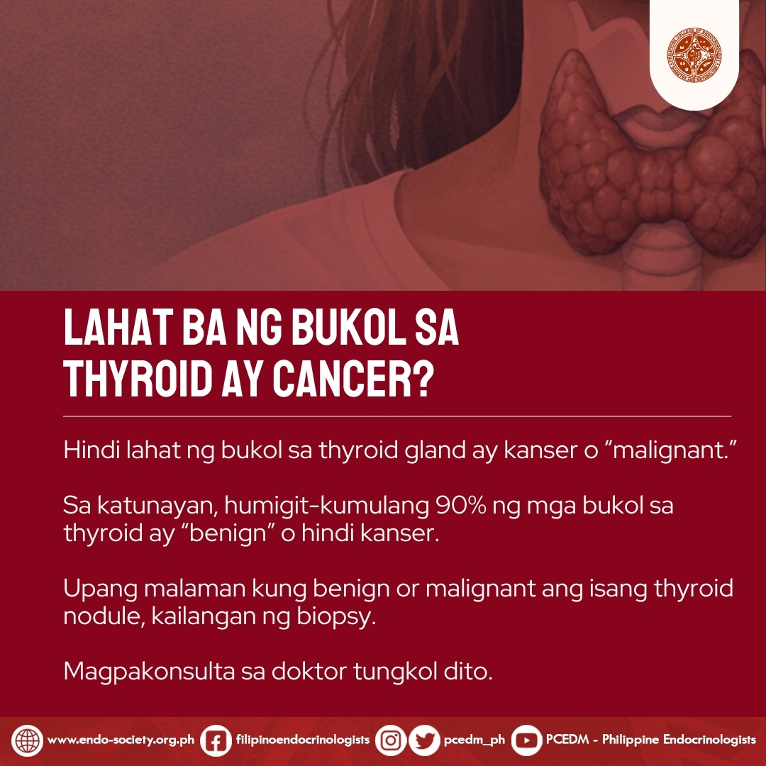 Hindi lahat ng bukol sa thyroid ay kanser.
90% dito ay benign.

Biopsy ang susi para malaman ang tunay na kondisyon. Magpakonsulta sa doktor para sa tamang diagnosis.

Follow PCEDM for more health related contents.

#PCEDM
#GoiterAwarenessWeek