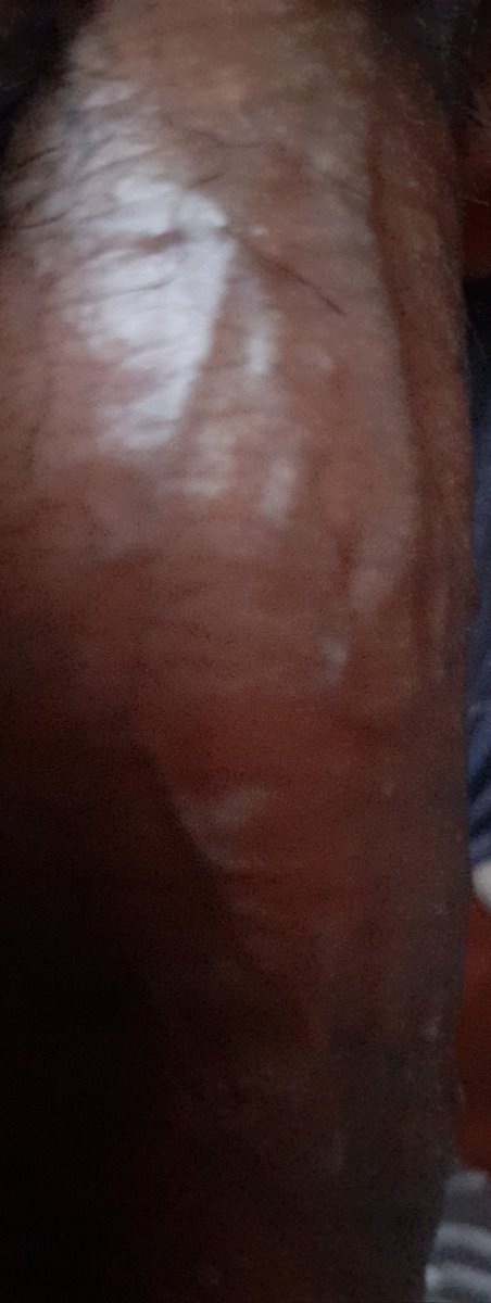 musclerunner2 tweet media