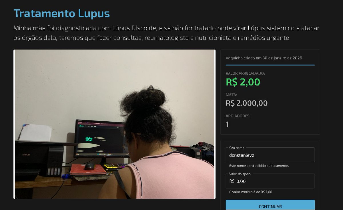 DonStanleyz's tweet image. Preciso da sua ajuda,  fiz uma vaquinha pra ajudar no tratamento do Lupus Discoide da minha mãe, ela é essa da foto, após ela ser diagnosticada agora ela terá que passar por um Reumatologista, um Nutricionista e precisará tomar pro resto da vida um remédio todos os dias pra queda…