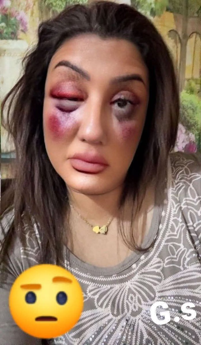 💚‏⫷إسہٰماعيٰل⫸🤍🇸🇦 tweet media