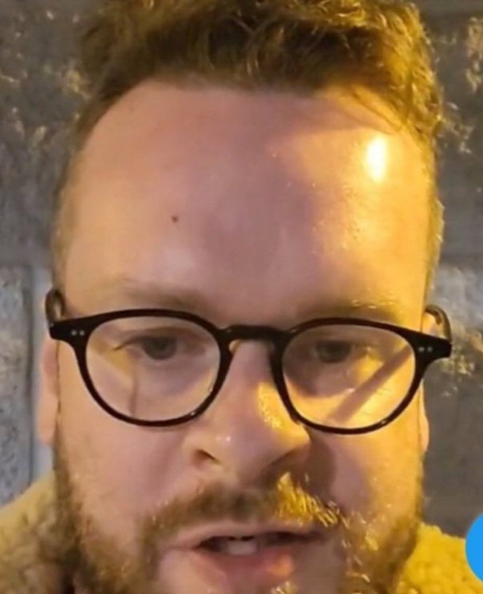 LilithLovett's tweet image. How come they all have this malformed bean shape to their heads?