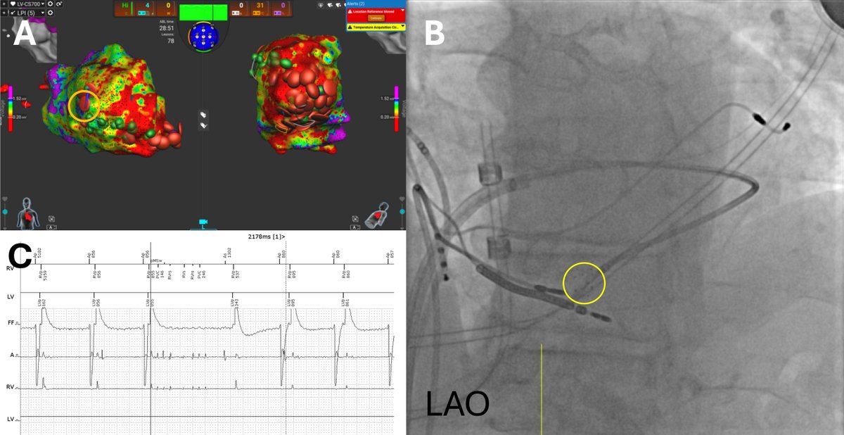 HeartRhythm tweet media