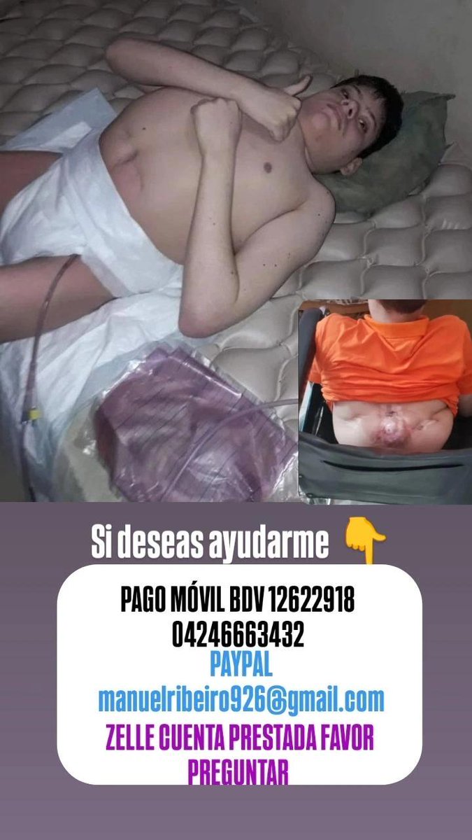 Hola 👋 en las últimas 3 semanas ayer un aporte de 530 bolívares, muchas gracias a la persona que me hizo el aporte. Agradezco a quienes puedan ayudar. AMERITO TRATAMIENTO DE POR VIDA. INSUMOS MÉDICOS DE POR VIDA A DIARIO. PAÑALES/CENTROS DE CAMA DE POR VIDA. CIPROFLOXACINA/OTROS
