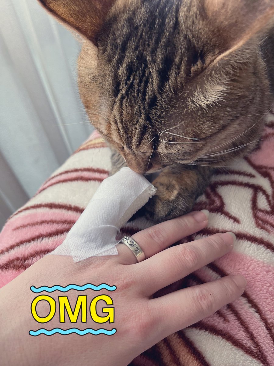 昨日切ったとこが痛すぎて寝れないレベルだったから痛み止めもらいに病院行ったら結果縫うことになってしもた🥺
自然治癒だと時間かかってバレーの大会出れないから、だったら縫った方が早いよ言われて…致し方なし🥺