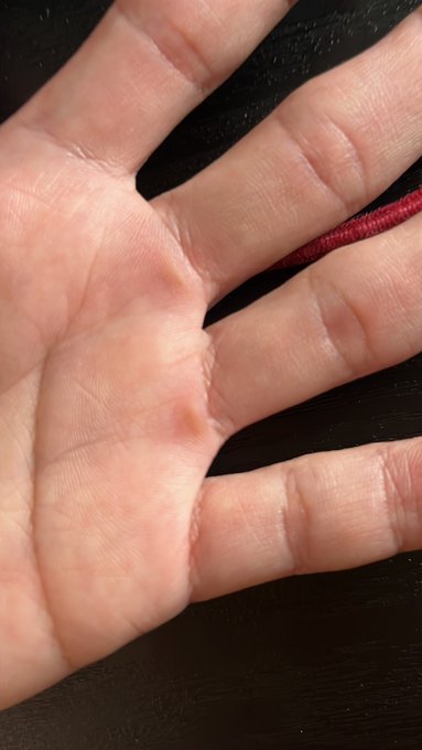 1月の
除雪で出来た
除雪だこ 