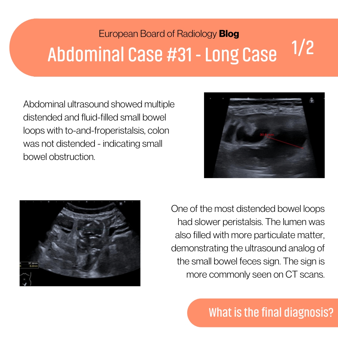 EuropeanBoardRadiology tweet media