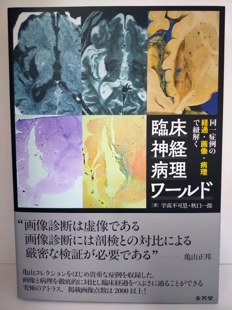 臨床神経病理ワールド』 #金芳堂 ISBN：9784765320412 同一症例の経過