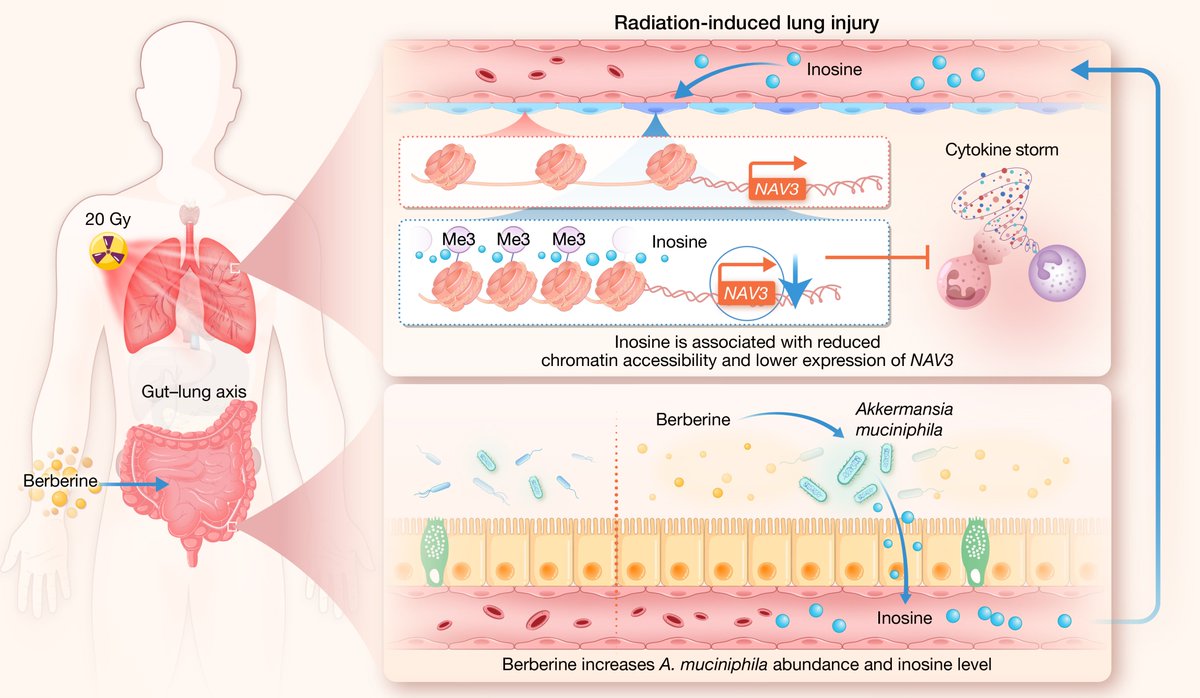 hLife_2023's tweet photo. Berberine alleviates radiation-induced lung injury by promoting microbiota-derived inosine via the gut–lung axis
Read more on hLife👇👇👇
https://t.co/VOC5fvFaCJ
#hLife #Science #Research #Health #healthjournal https://t.co/hrINM5PrTK