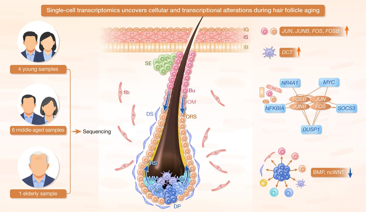 hLife_2023's tweet photo. Single-cell RNA sequencing profiles age-related transcriptional landscapes in human hair follicle cells
Read more on hLife👇👇👇
https://t.co/66fuT9RcQn
#hLife #Science #Research #Health #healthjournal https://t.co/VrAjVDll0A