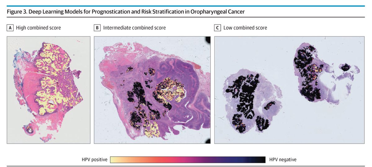 JAMA Otolaryngology – Head & Neck Surgery tweet media