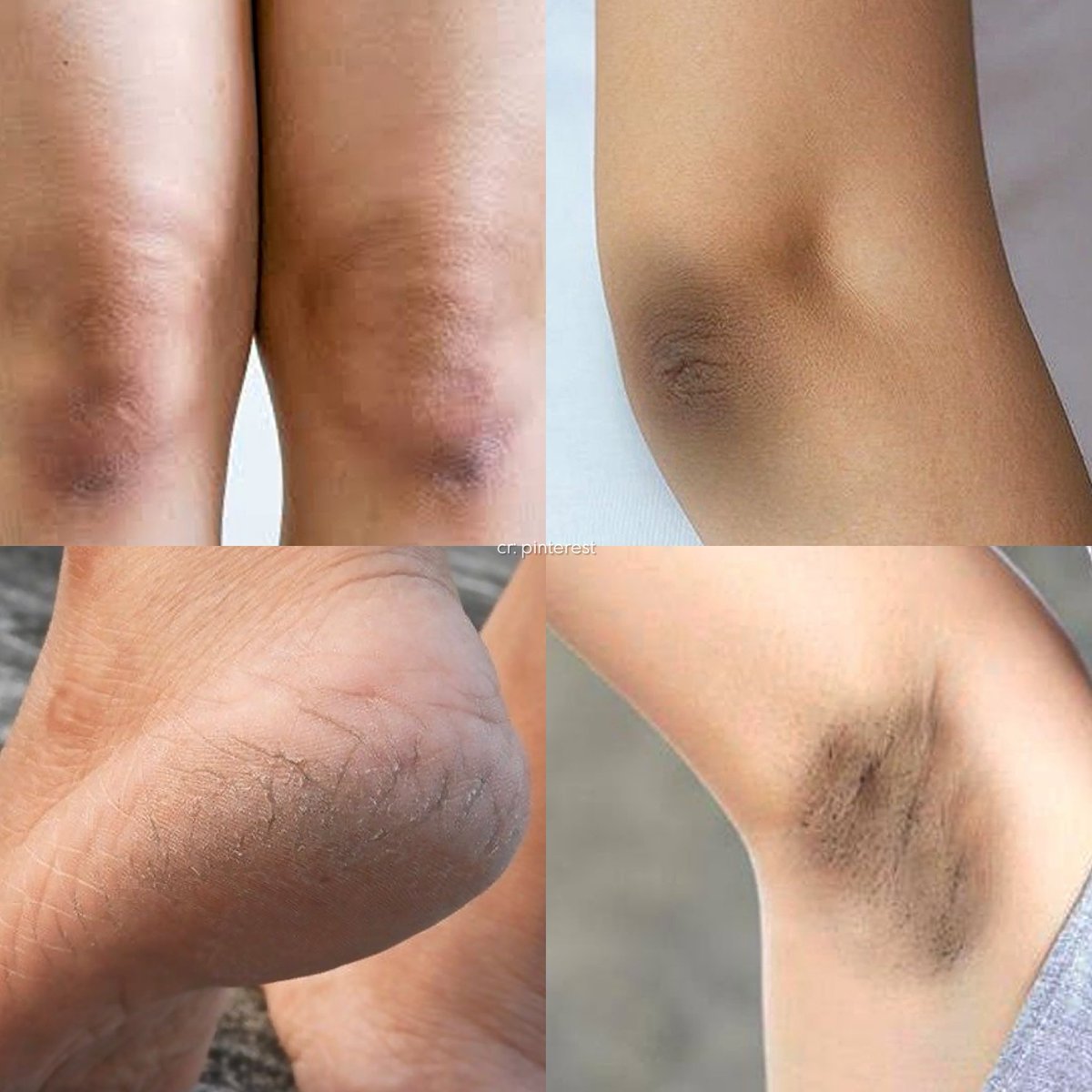 berburushopee's tweet image. the problem                                the solution