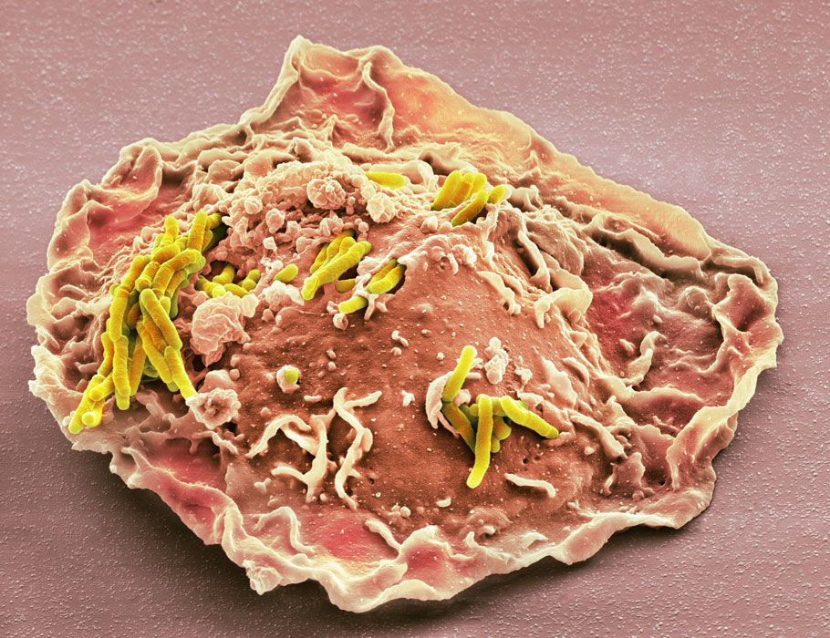 ScienceMagazine's tweet photo. A new @SciImmunology study shows that mycobacterium tuberculosis can survive within macrophages by binding dectin1 and altering phagosome maturation and autophagy. https://t.co/sYPSHRPwPM https://t.co/EuonDYpCxk