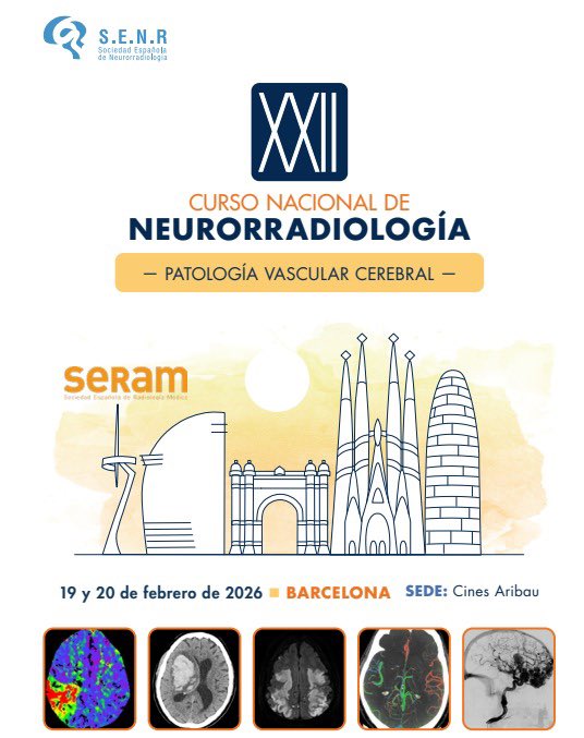 SENR_org's tweet photo. 📌 XXII Curso Nacional de Neurorradiología (SENR)
🧠 Patología vascular cerebral
📅 19–20 febrero 2026
📍 Barcelona – MOOBY Aribau Cinema

Programa e inscripciones 👇
https://t.co/zT00jagwBI

#SENR #Neurorradiología #Ictus #Neuroimagen https://t.co/SA40DUvBTW