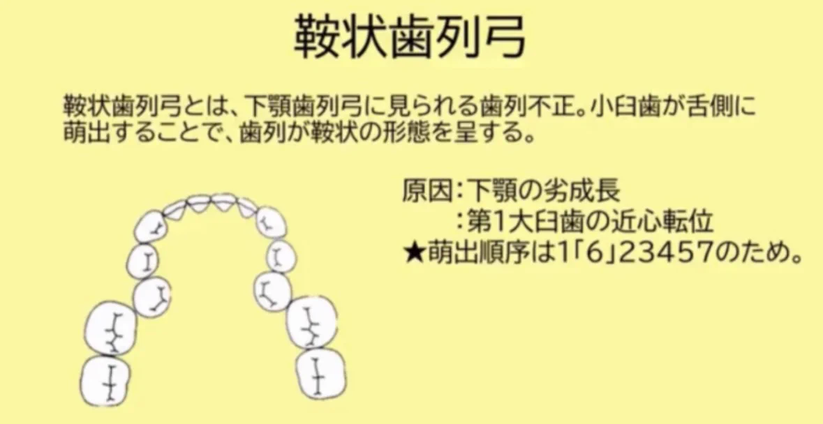 歯科医師国家試験対策 ロムニーハウス勉強会【講師 Dr.N】 on X: 