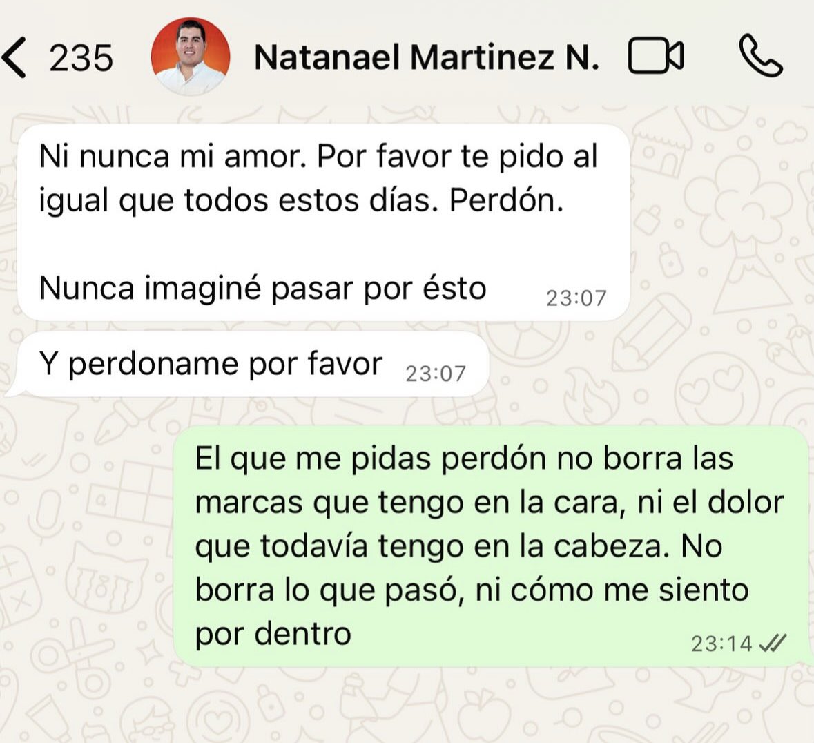 Raulbogarin's tweet photo. 🚨 Precandidato a intendente de Ypané acusado por violencia familiar. 
-Milena Páez denunció públicamente a su ex pareja, Natanael Martínez, precandidato a intendente de Ypané, a quien acusa por hechos de maltrato físico y verbal durante el tiempo que mantuvieron una relación.
-La mujer afirmó que decidió hablar “por respeto a sí misma y a su valor como mujer”, señalando que vivió “un infierno” y que el silencio ya no era una opción.

📍Ypané